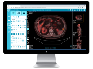 DICOM viewer online