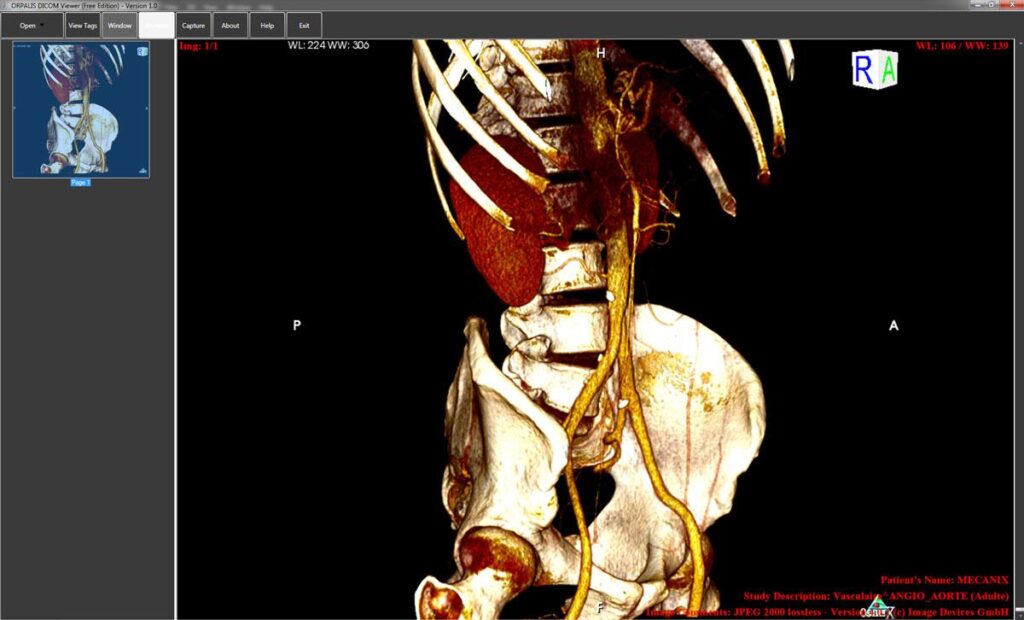 DICOM viewer online